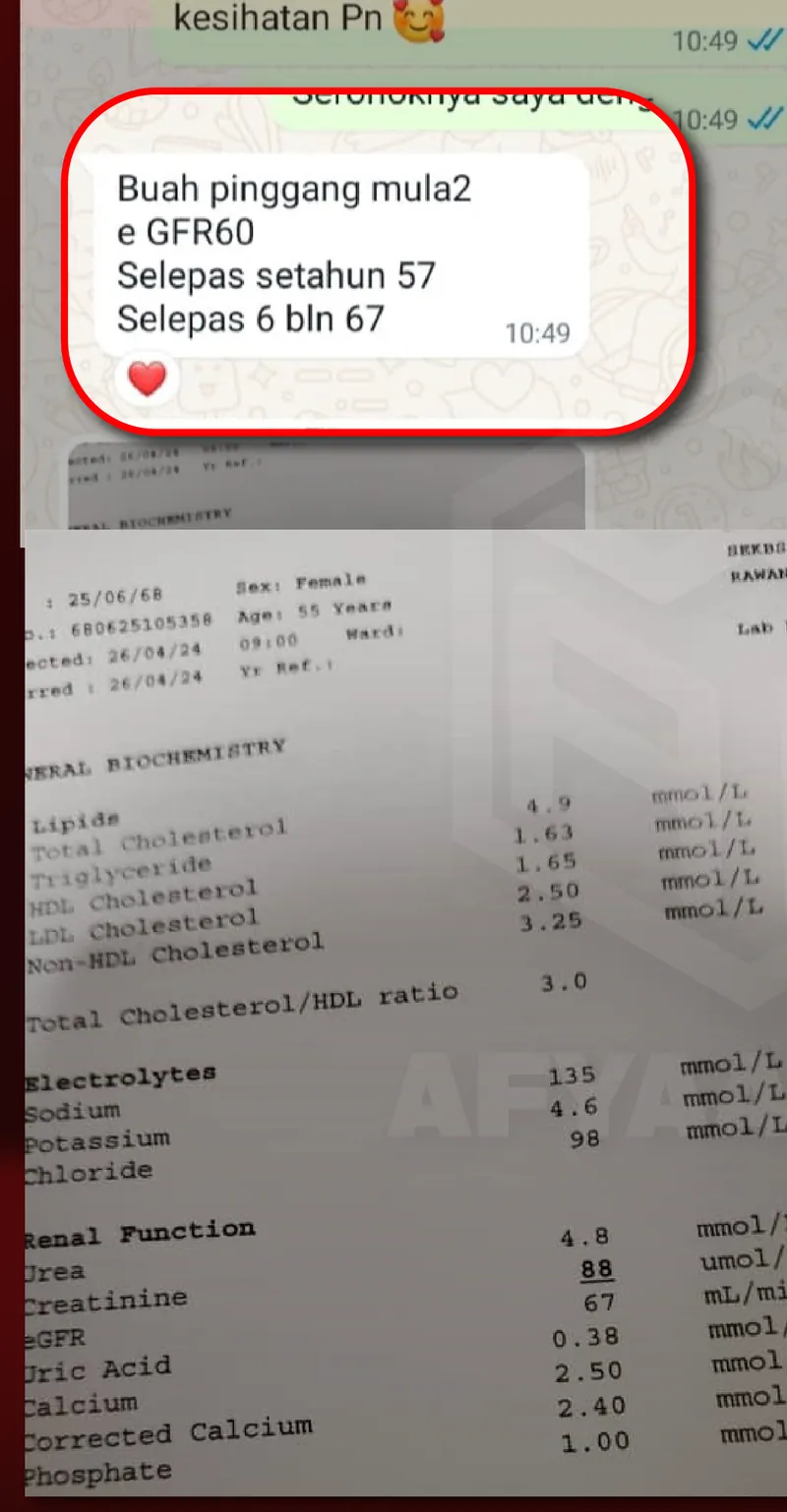 Testimoni WhatsApp: Bacaan eGFR dah Naik & Kreatinin dah Kembali Normal